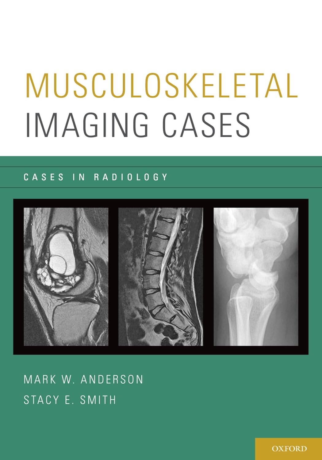 Buy Musculoskeletal Imaging Cases (Cases In Radiology) (English, Paperback, Mark W. Anderson, Stacy E. Smith) Online at Best Price - GlowMirror