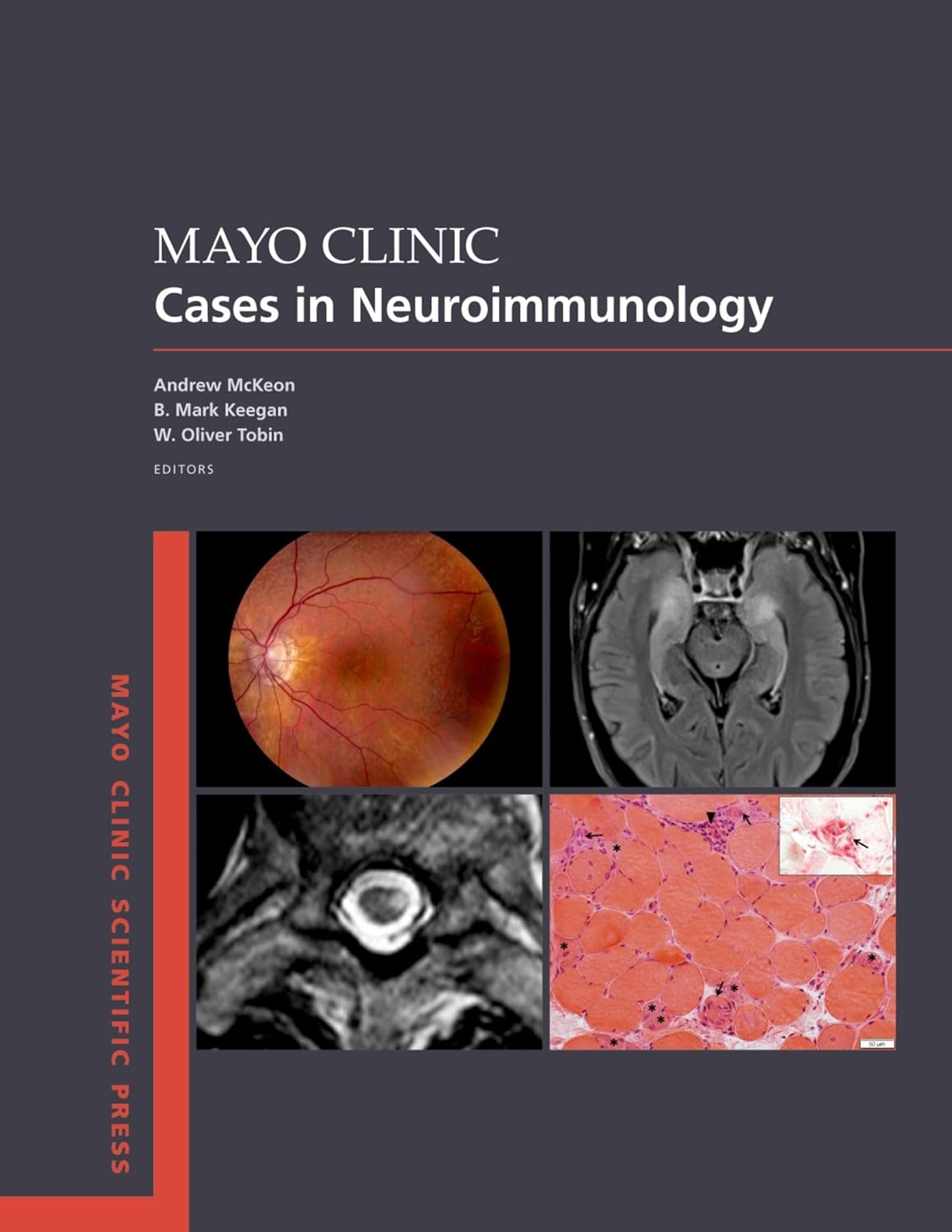 Buy Mayo Clinic Cases in Neuroimmunology (Mayo Clinic Scientific Press) (English, Paperback, Andrew McKeon, B Mark Keegan, W Oliver Tobin) Online at Best Price - GlowMirror