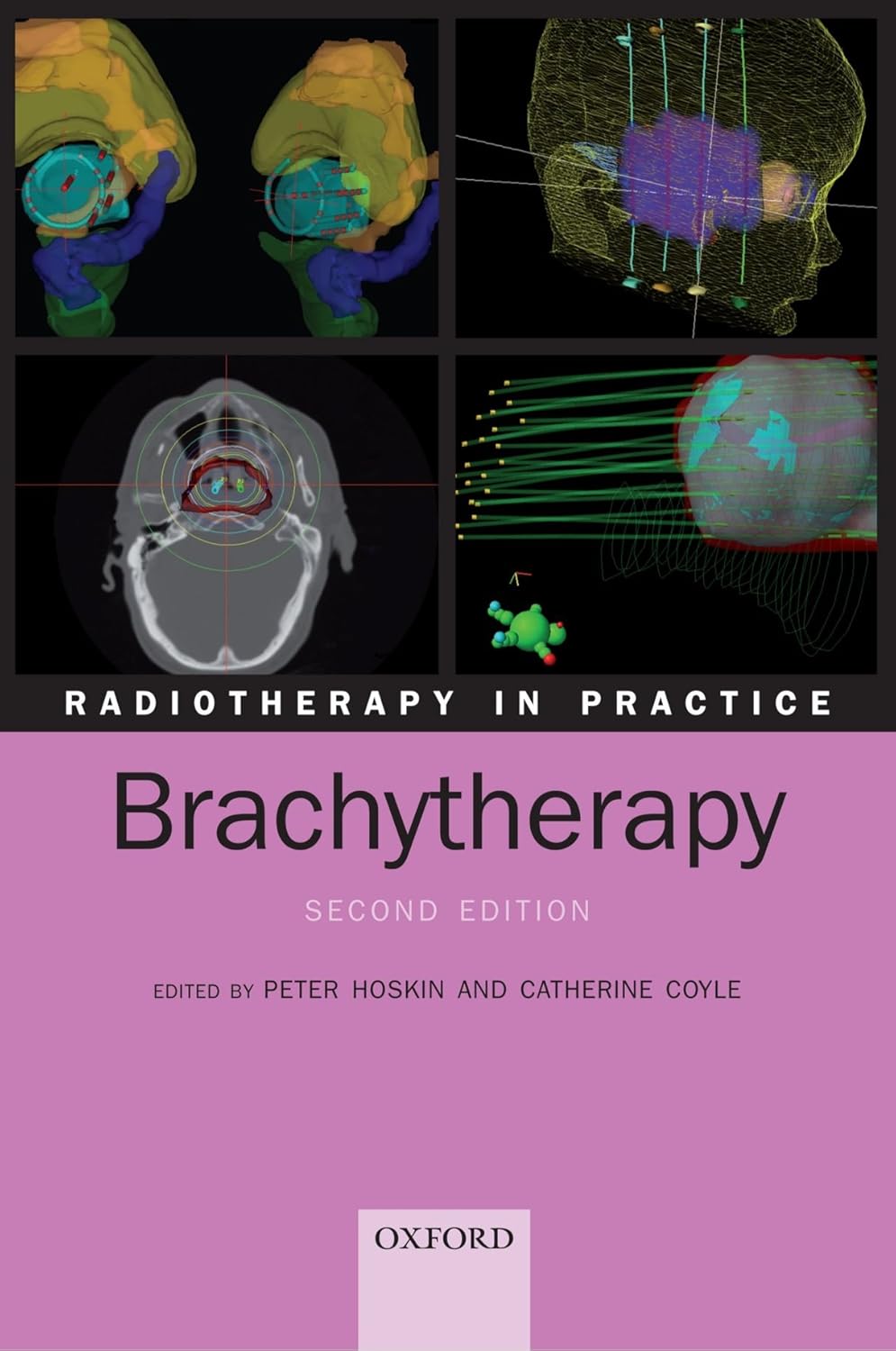 Buy Radiotherapy in Practice - Brachytherapy (English, Paperback, Peter Hoskin, Catherine Coyle) Online at Best Price - GlowMirror