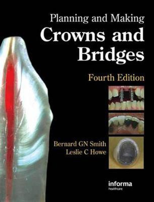 Buy Planning and Making Crowns and Bridges (English, Paperback) Online at Best Price - GlowMirror