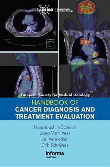 Buy ESMO Handbook of Cancer Diagnosis and Treatment Evaluation (English, Paperback) Online at Best Price - GlowMirror