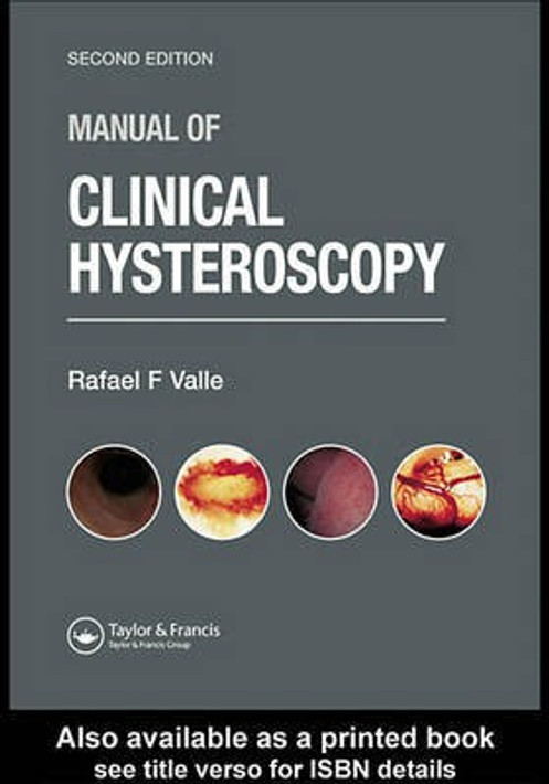 Buy Manual of Clinical Hysteroscopy, Second Edition (English, Paperback) Online at Best Price - GlowMirror