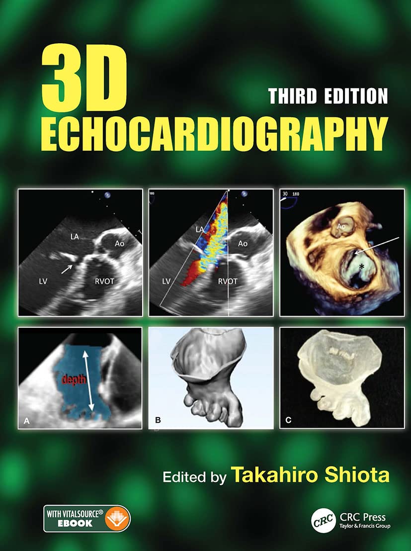 Buy 3D Echocardiography (English, Hardcover, Takahiro Shiota) Online at Best Price - GlowMirror