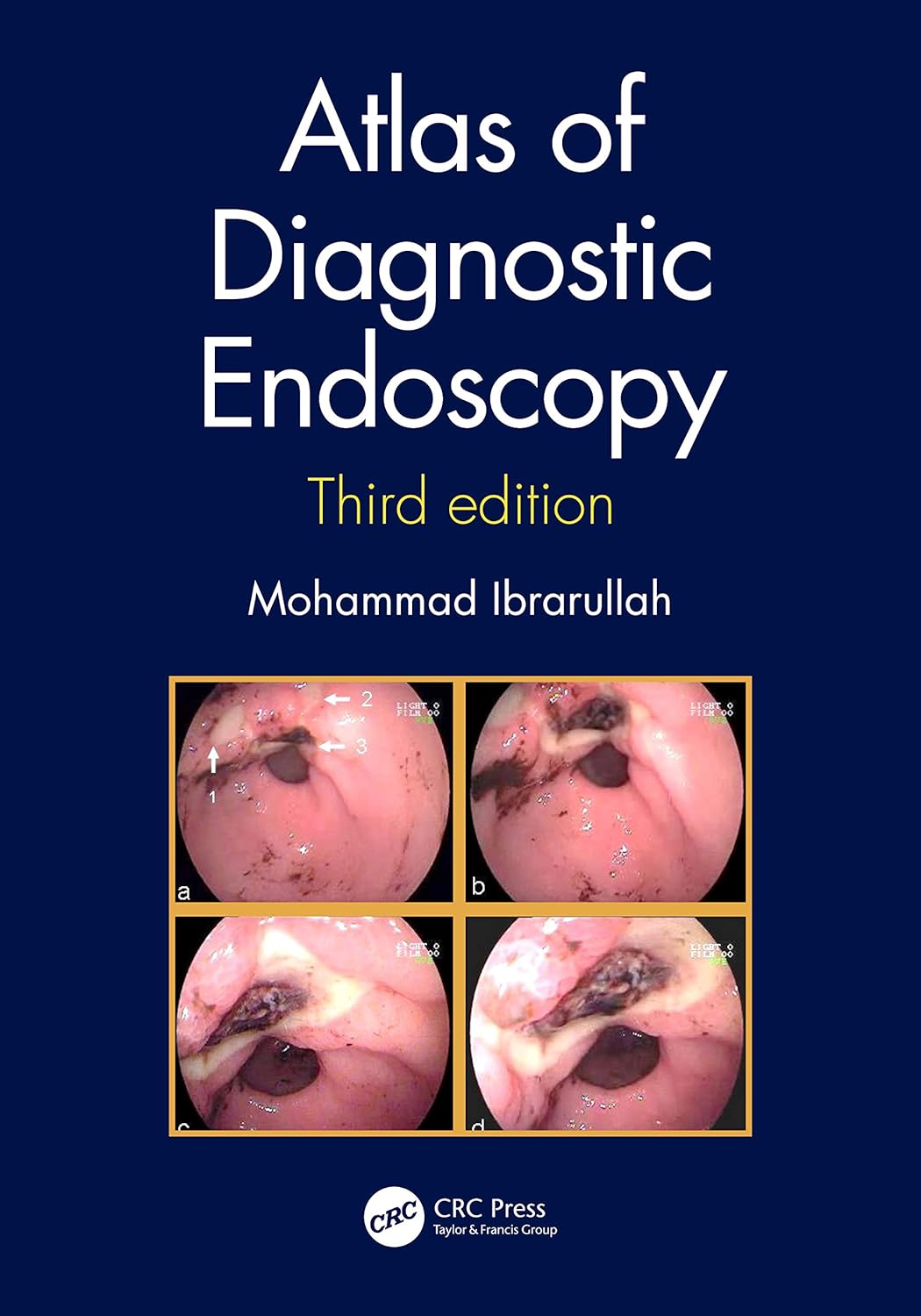 Buy Atlas OF Diagnostic Endoscopy 3ED (HB 2020) (English, Paperback, Mohammad Ibrarullah) Online at Best Price - GlowMirror