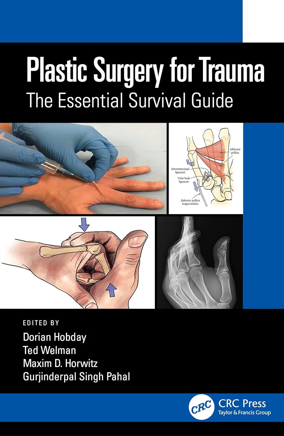 Buy Plastic Surgery for Trauma: The Essential Survival Guide (English, Paperback, Dorian Hobday, Ted Welman, Maxim D. Horwitz, Gurjinderpal Singh Pahal) Online at Best Price - GlowMirror
