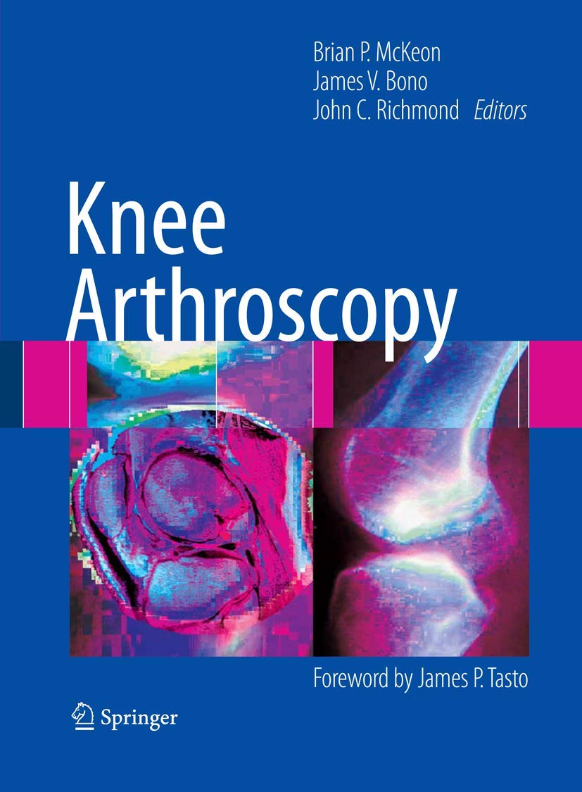 Buy Knee Arthroscopy (English, Paperback, Brian P McKeon, James V Bono, John C Richmond MD) Online at Best Price - GlowMirror