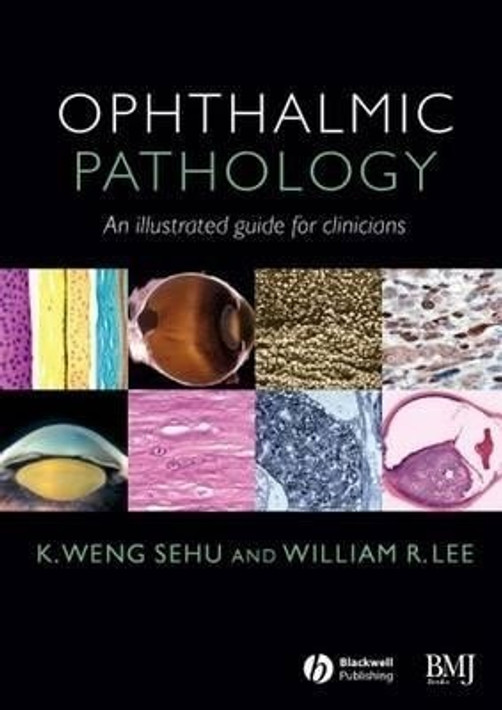 Buy Ophthalmic Pathology (English, Paperback) Online at Best Price - GlowMirror