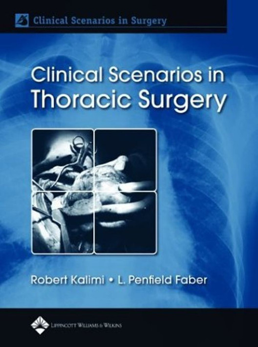 Buy Clinical Scenarios in Thoracic Surgery (English, Paperback) Online at Best Price - GlowMirror
