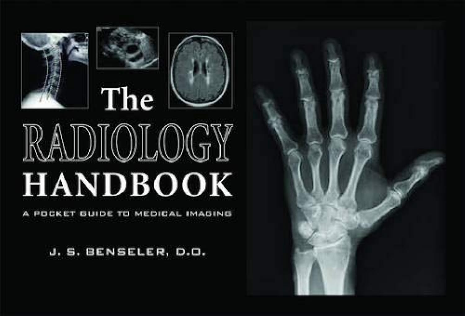 Buy The Radiology Handbook: A Pocket Guide to Medical Imaging (White Coat Pocket Guide Series) (English, Paperback, J. S. Benseler) Online at Best Price - GlowMirror