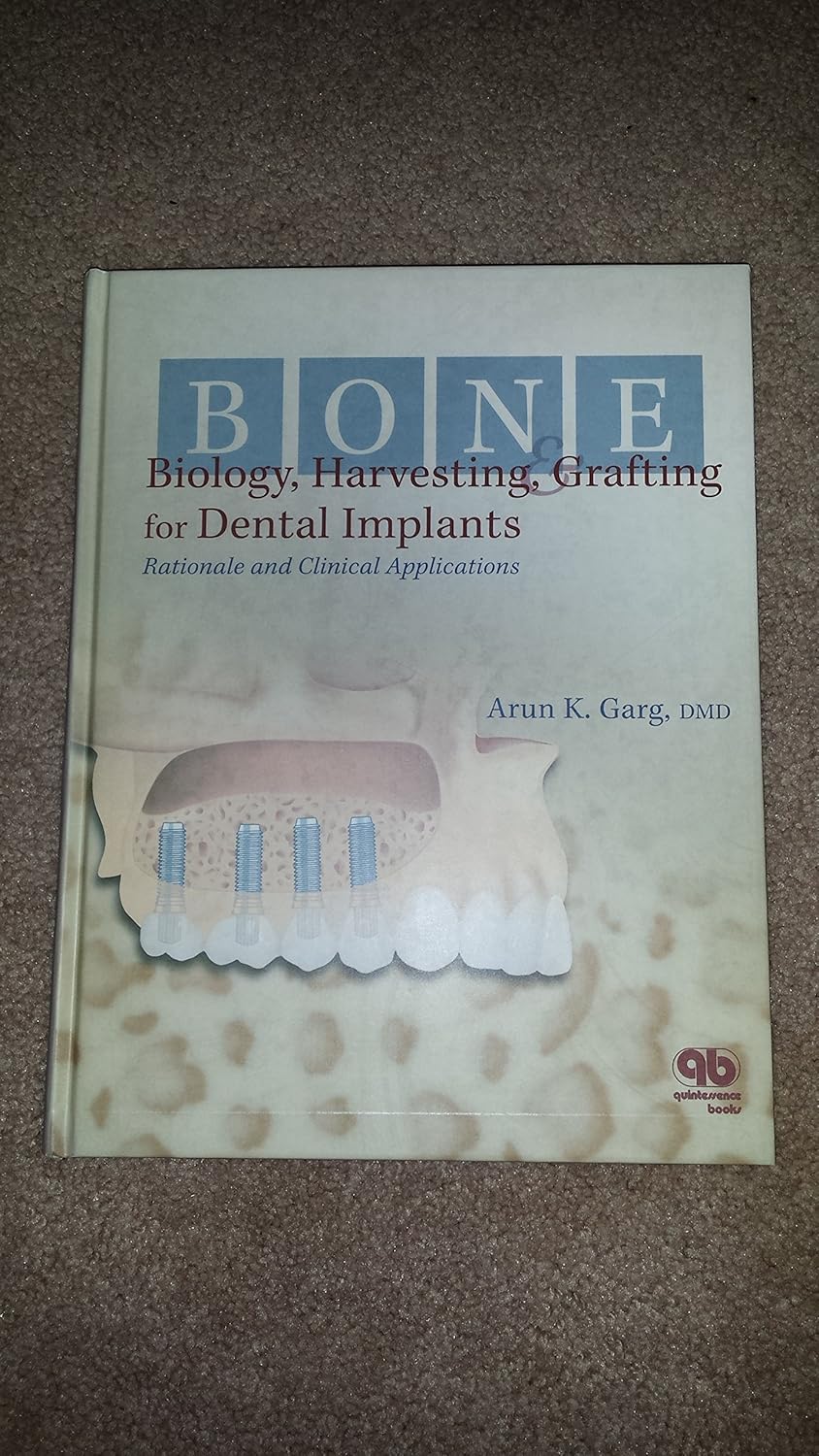 Buy Bone Biology, Harvesting and Grafting for Dental Implants: Rationale and Clinical Applications (English, Hardcover, Arun K. Garg) Online at Best Price - GlowMirror