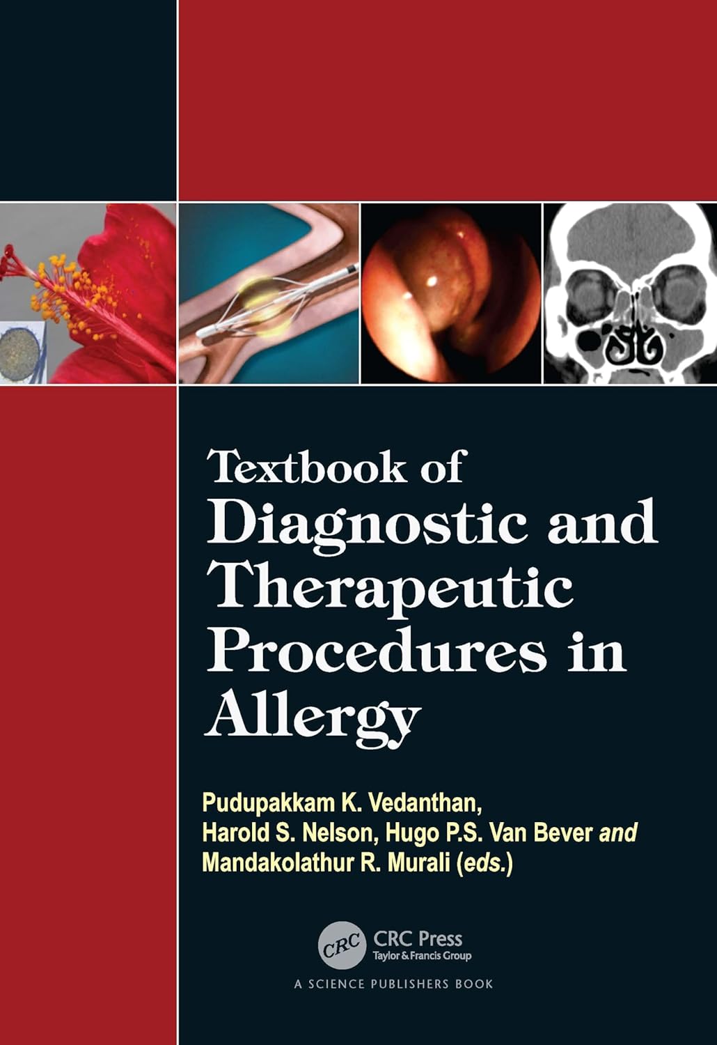 Textbook of Diagnostic and Therapeutic Procedures in Allergy (English, Paperback, Pudupakkam K. Vedanthan, Harold S. Nelson, Hugo Van Bever, Mandak...