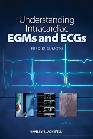Buy Understanding Intracardiac EGMs and ECGs (English, Paperback, Fred Kusumoto) Online at Best Price - GlowMirror