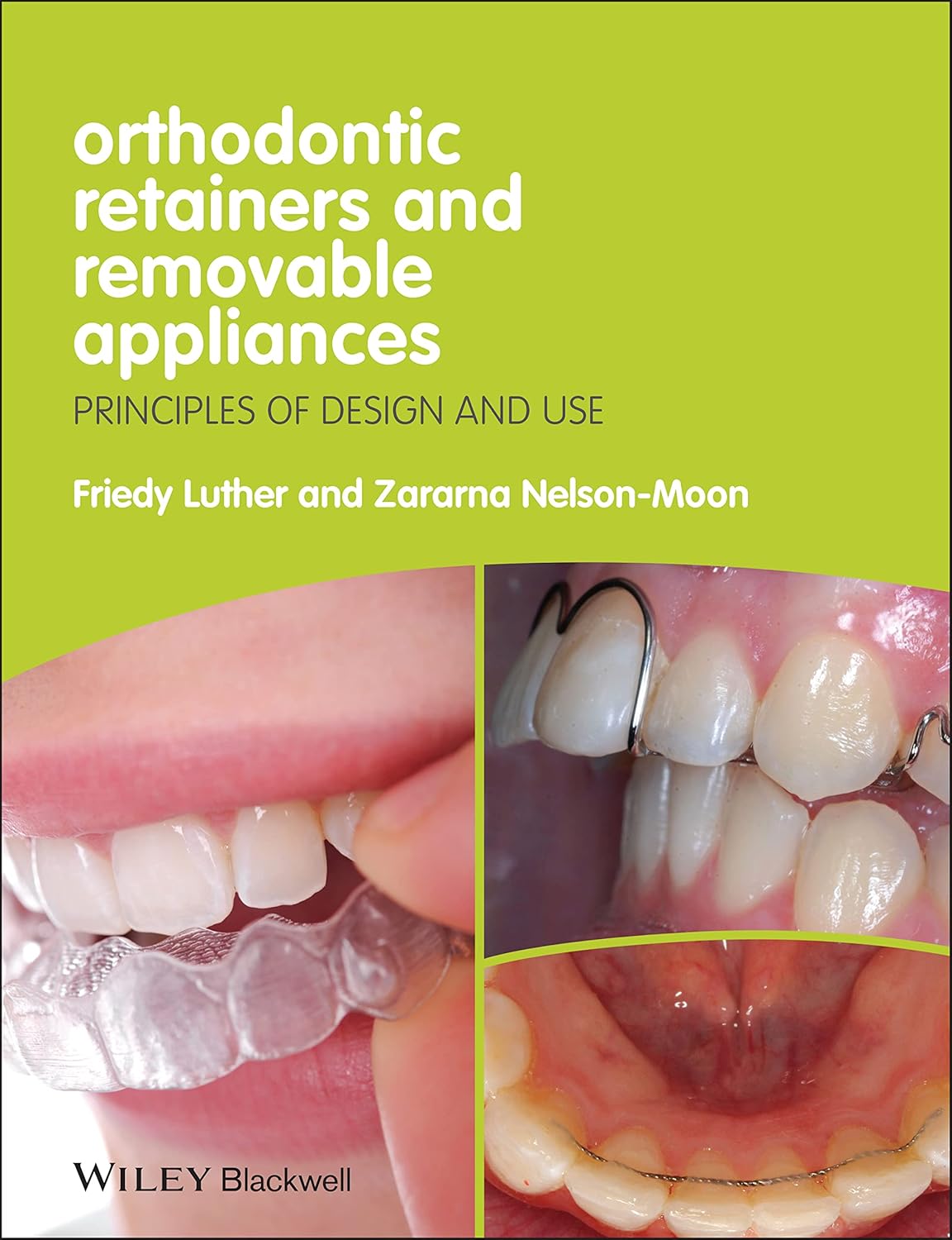 Buy Orthodontic Retainers and Removable Appliances: Principles of Design and Use (English, Paperback, Friedy Luther, Zararna Nelson-Moon) Online at Best Price - GlowMirror